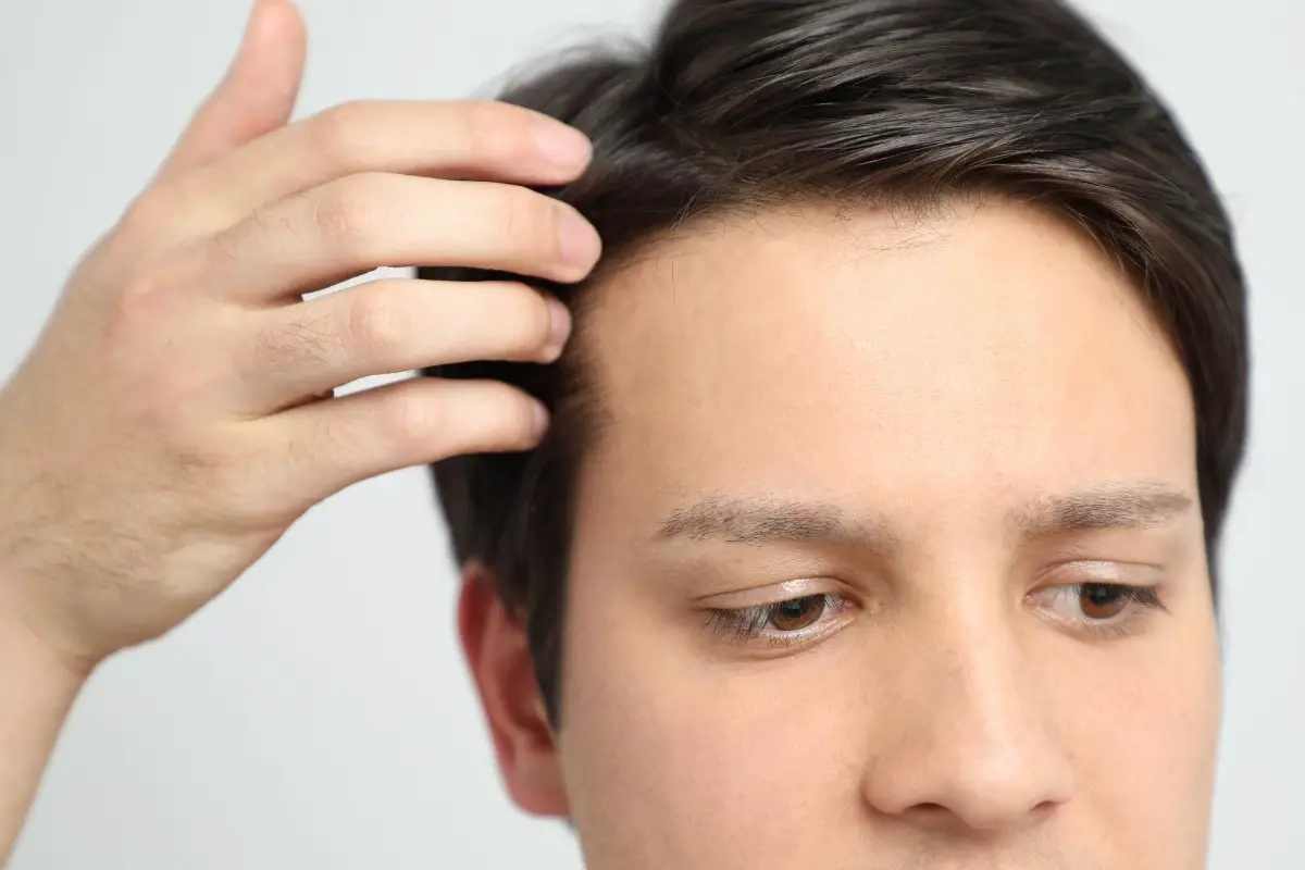 How To Get A Smaller Forehead Male Inspire Ideas